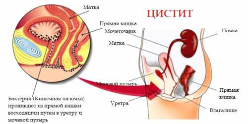 профилактика эндометрита у собак